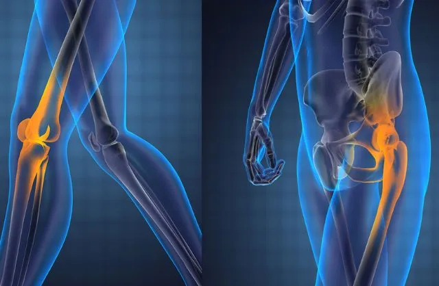 Knee & Hip Replacement in India